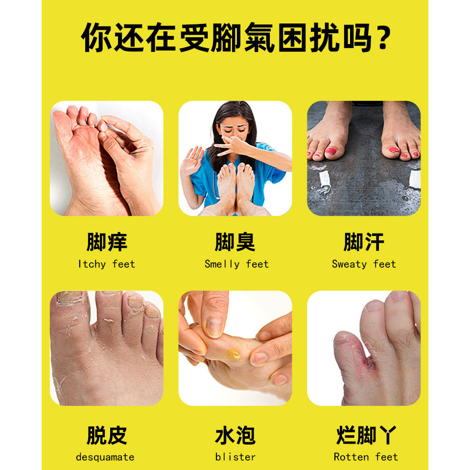 Foot Ointment Skin Athletes Athletes Herbal Foot Odor Blister Gift จะขาย Night Market Stall ขายส่ง A