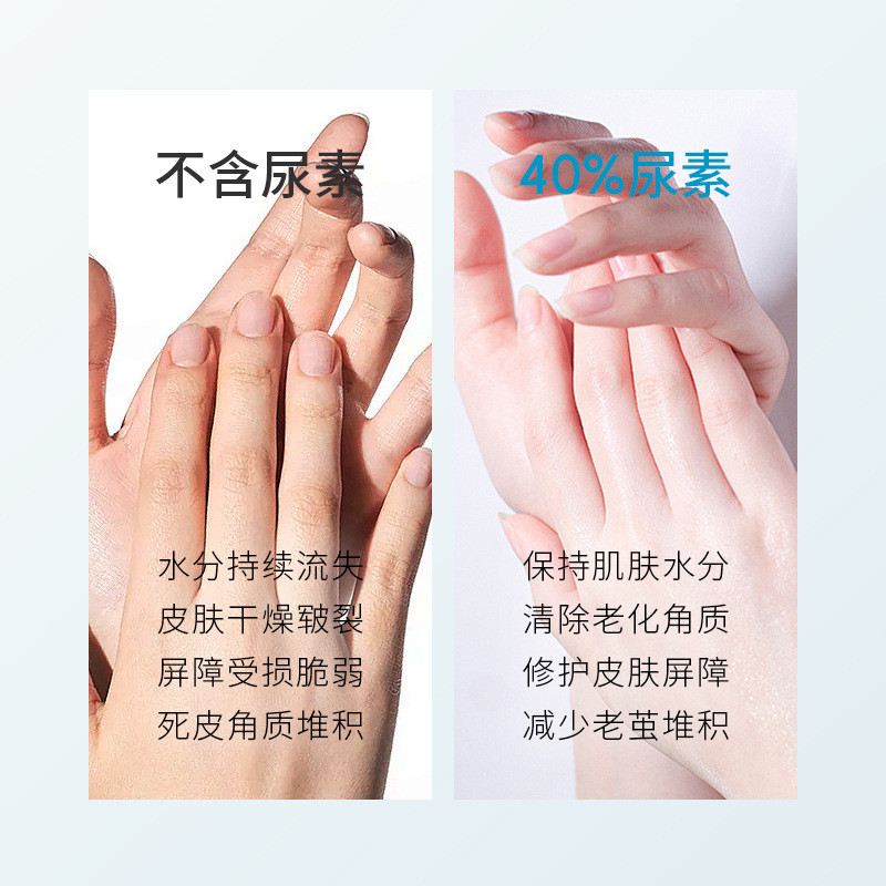 Vaseline Dry Hands Foot Cream Cracked Cream Moisturizing Foot Care 40% Urea Foot Cream AKDX