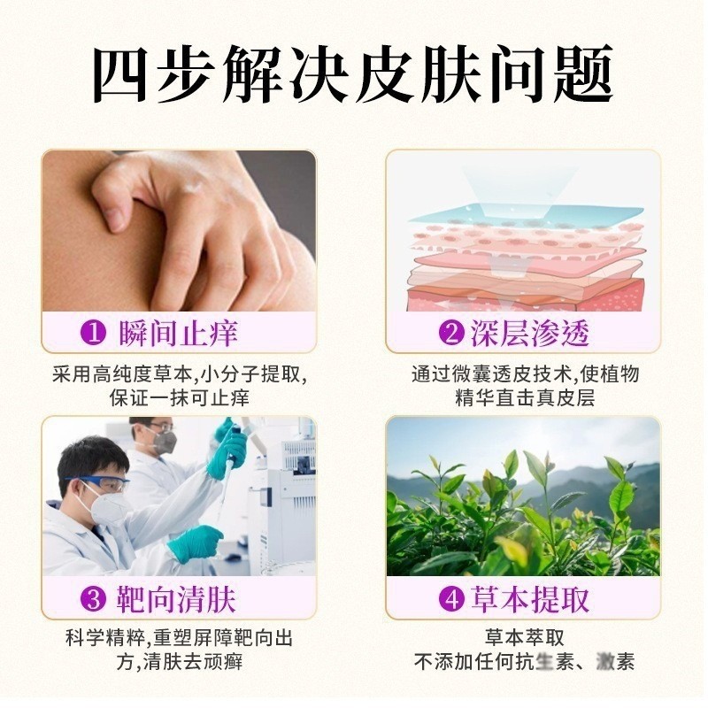 Anti-itch Bacteria Thai Cream Anti-itch Anti-mosquito Makeup 7.1 Anti-Wang Cream Doctor Anti-itch Cr