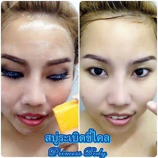 สบู่หน้าใส ของแท้ สบู่ผิวขาว ลดฝ้า ลดรอยสิว สบู่ลดสิว ลดหน้ามัน กระชับรูขุมขน สบู่ หน้าขาว กระจ่างใส