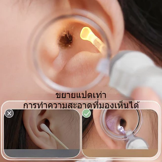 COD เครื่องมือหยิบหูพร้อมไฟ สองแสง แหนบขุดหู ใช้ได้ทั้งเด็กและผู้ใหญ่ ภาพที่ขยายได้ หัวช้อนซิลิโคนไม่ทำร้ายช่องหูของทารก