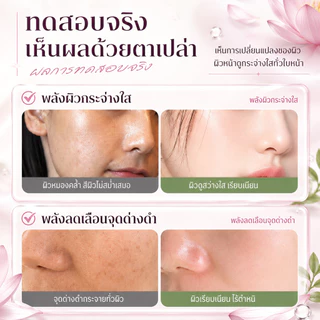 ครีมลดฝ้า กระ จุดด่างดำ สมุนไพรบำรุงผิวหน้า ผิวชุ่มชื้น กระจ่างใส ลดหมองคล้ำ ควบคุมความมัน 50ml