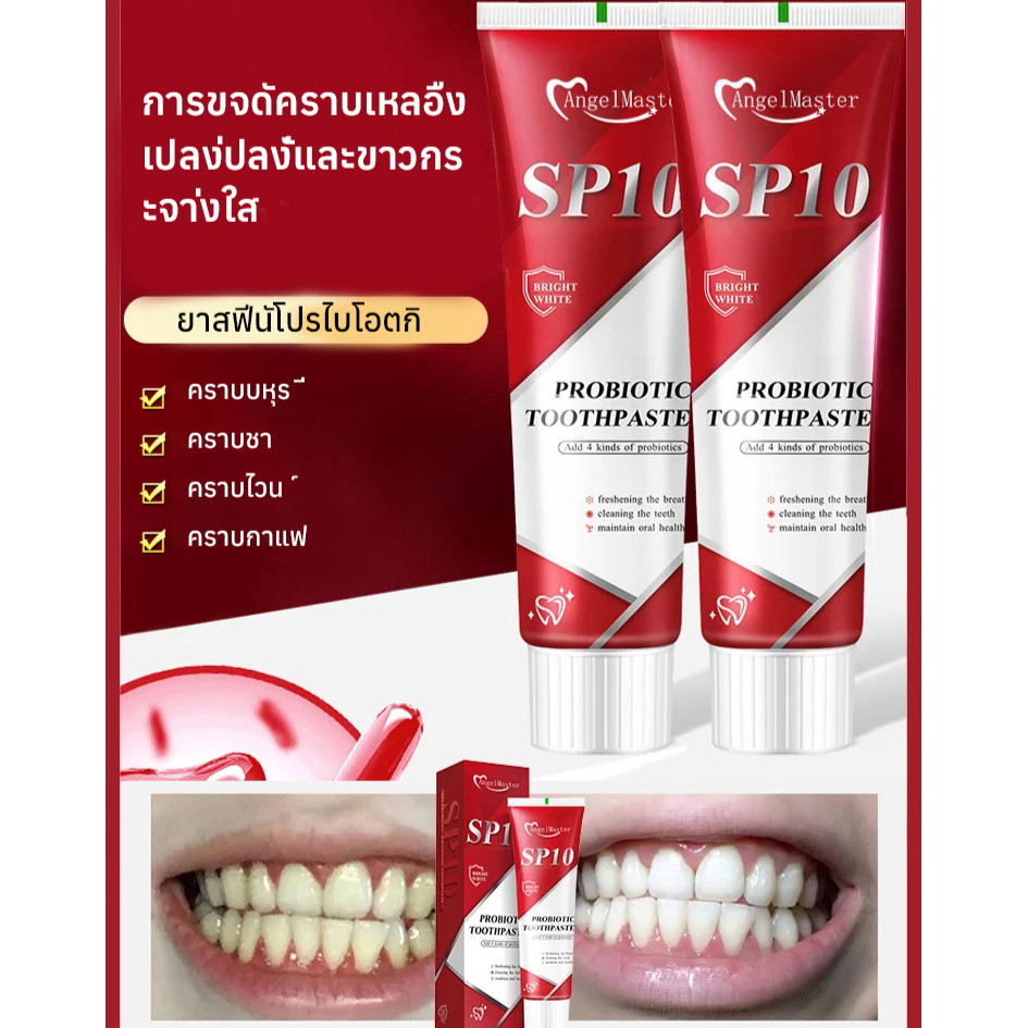 ยาสีฟันโปรไบโอติก SP10 ฟอกฟันขาวทันใจ ลดกลิ่นปาก ดูแลช่องปาก Whitening Toothpaste ลดหินปูน เหนือกว่า