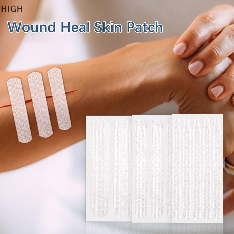 สูง 2/3/5 ชิ้นแผลรักษาผิว Patch Band Aid สําหรับเด็กผู้ใหญ่เย็บแผลกาวผ้าพันแผล Stiing พลาสเตอร์ DDC
