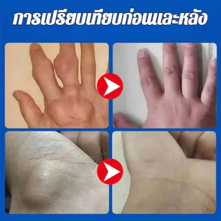 🔥 แผ่นประคบร้อนข้อมือ ให้ความร้อน 3 มิติ ผสานสมุนไพรจิงจูฉ่าย บรรเทาอาการปวดเมื่อย