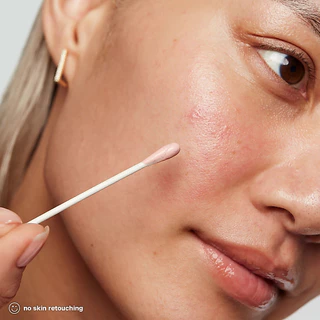 ⚡แท้💯 ส่งไว⚡ TheSkincare.TH | (New Package) Exp.03/28 Kate Somerville EradiKate Acne Treatment