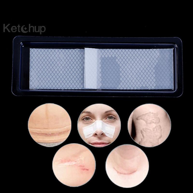 [Ktchup-t] 1X แพทช์กําจัดรอยแผลเป็นซิลิโคนใสลบ Trauma Burn Sheet Skin Repair Nice