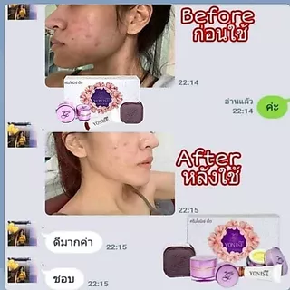 ⚡ถูกที่สุด⚡ขายดีที่สุด ของแท้ส่งตรงจากบริษัท #ครีมโยนิเซ่​ Yonise 🎁มีของแถมทุกกล่อง