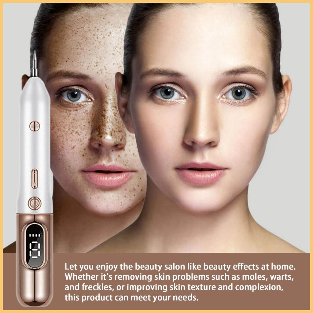 Wart Remover ปากกา Dark Spot Remover เครื่องมือถือ Spot Freckle Removal เครื่องชาร์จ Wart Removal ปา