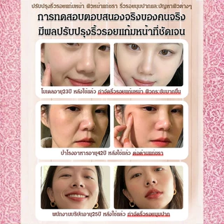 💥เวอร์ชันอัพเกรดใหม่💥แผ่นมาส์กลดริ้วรอยฉุกเฉิน แผ่นแปะต่อต้านริ้วรอยบนใบหน้า แผ่นแปะต่อต้านริ้วรอยจากถุงใต้ตา แปะใต้ตา ลดถุงใต้ตา ผิวเรียบเนียน เหมาะสำหรับทุกสภาพผิว ใช้ง่ายสะดวก