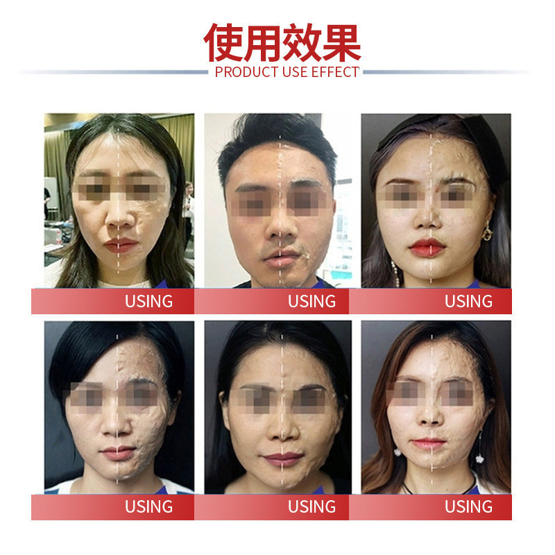 Hot Sale#Witch Mask Brush Enzyme Lifting Firming Nasolabial Folds Beauty Salon Application Mask Beau