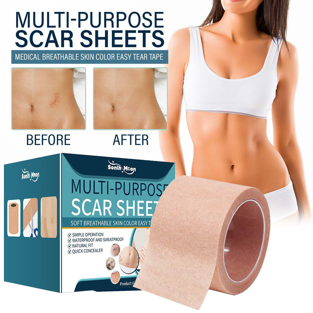 สินค้าใหม่ sonlh mno Skin Tone คอนซีลเลอร์ Patch SON003 ฝาครอบ Body Scars Skin Tone Patch ฝาครอบ Pat