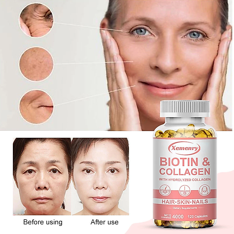Biotin Collagen 4000 Mcg - วิตามินบำรุงสุขภาพผม ผิว เล็บ กระดูกและข้อ