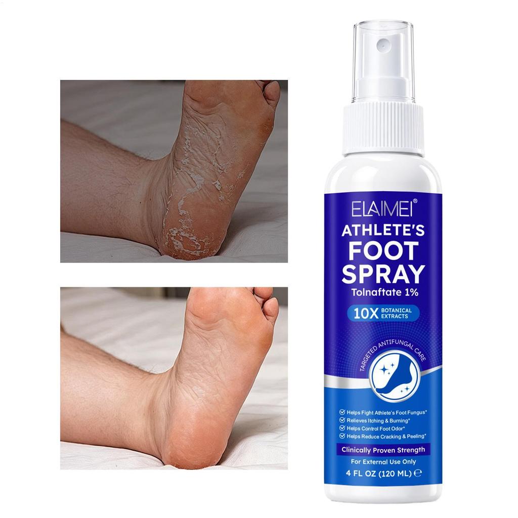Athlete Foot Spray Itch Relief Quick-Drying Liquid 120ml Peeling Athlete Foot Spray otakwph