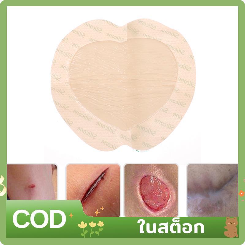 1 ชิ้นซิลิโคนแผล Patch Bedsore Dressing Patch สําหรับความดัน Ulcer