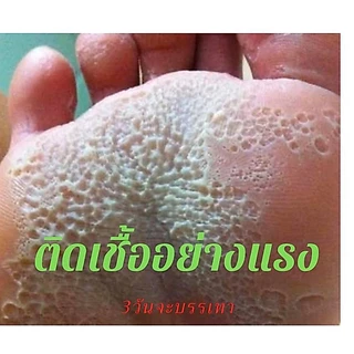 แป้งดับกลิ่นเท้า เท้าเหม็น เท้าเป็นรู