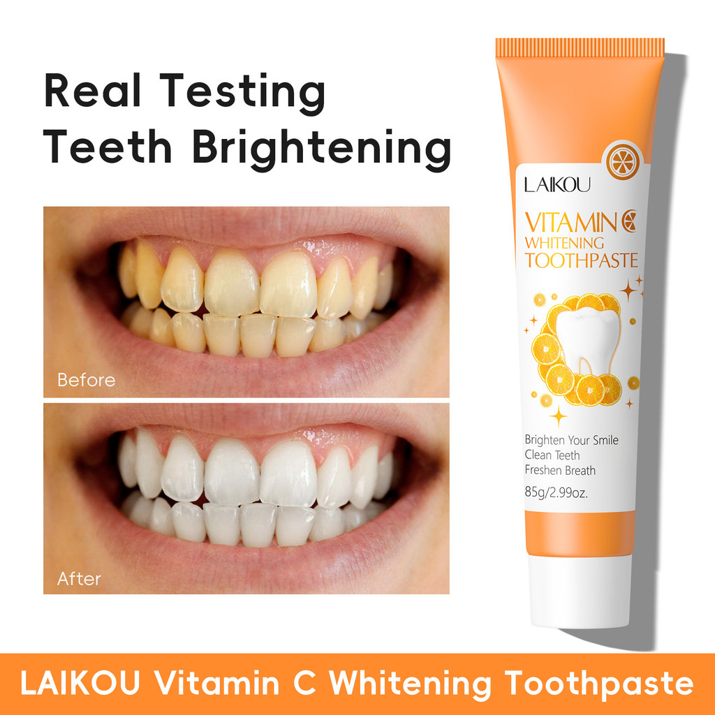 Gum Care TOOTHP ยาสีฟัน 85g ขจัดคราบฟัน วิตามินซี ลมหายใจสดชื่น Lyco TEAS7.1