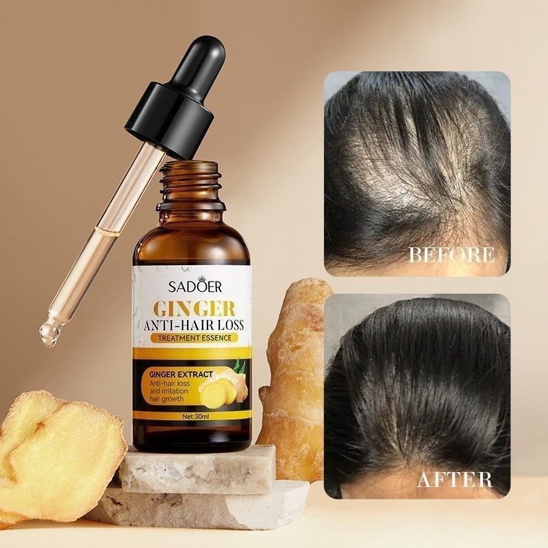 SADOER Ginger Hair Care Essence Serums ปรับปรุง Frizz Dry Conditioner Oil FFG9126 @