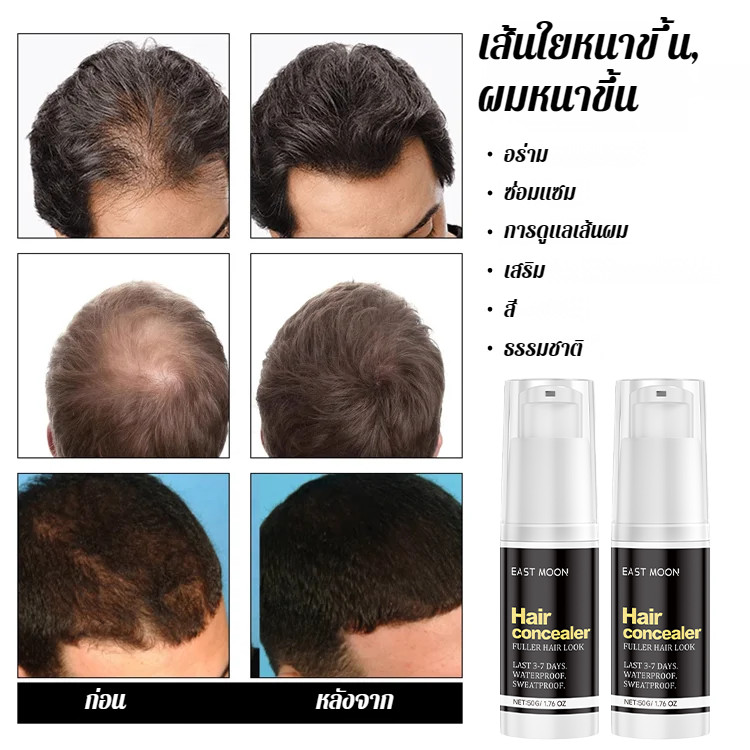 🩵มีคนจำนวนมากซื้อ🩵 【มีผลทันที คงอยู่ได้นาน 10 วัน】คอนซีลเลอร์ปิดเหม่ง กันน้ำ/กลบรอยล้านบนศีรษะ​/​​คอนซีลเลอร์สำหรับคนผมบาง​/ร์ป้องกันรอยเปื้อนติดทนนานกันน้ําและกันเหงื่อ - รูปที่ 5