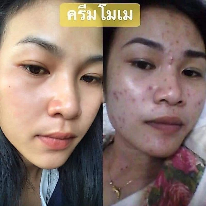 ครีมเอลลี่โมเม ไนท์ครีมบำรุงผิว ขนาด 10g thumbnail 10