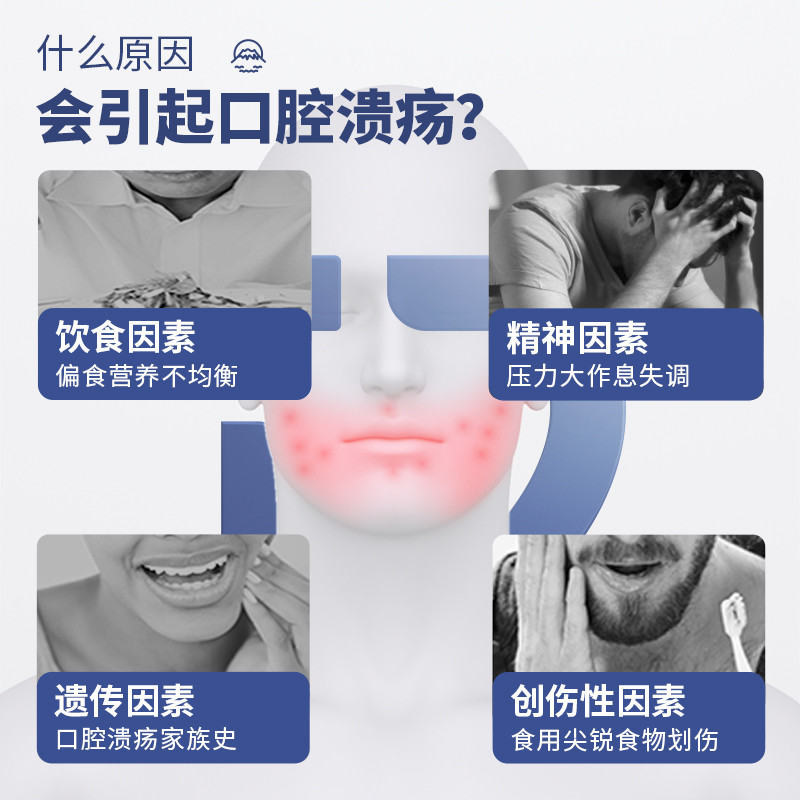 ดร. Rotaus Oral Ulcer Gel Spray Oral Ulcer Repair Liquid Medical Dressing ลดพื้นที่ Ulcer ฯลฯ