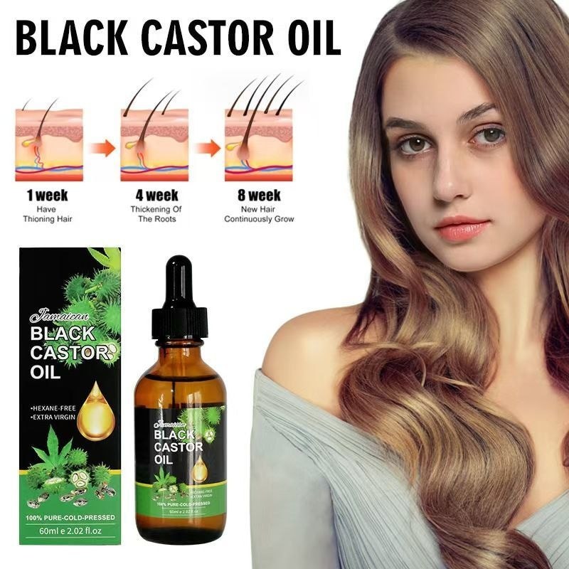 OUHOE Castor Oil Density Hair Lotion ปรับปรุง Hairline Strong Hair บํารุงผมรากผมนุ่มผมร่วงป้องกันควา