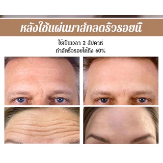💥เวอร์ชันอัพเกรดใหม่💥แผ่นมาส์กลดริ้วรอยฉุกเฉิน แผ่นแปะต่อต้านริ้วรอยบนใบหน้า แผ่นแปะต่อต้านริ้วรอยจากถุงใต้ตา แปะใต้ตา ลดถุงใต้ตา ผิวเรียบเนียน เหมาะสำหรับทุกสภาพผิว ใช้ง่ายสะดวก