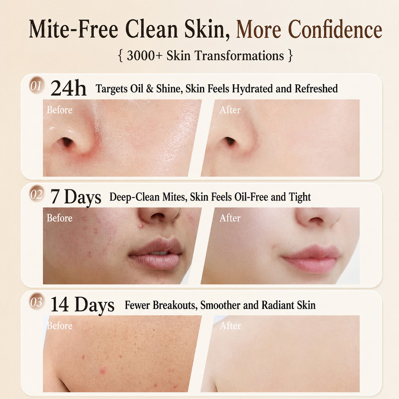 Qi Zi Bai Herbal Whitening Soap / สูตรน้ํามันมะพร้าวธรรมชาติ / เพิ่มความกระจ่างใส & Evens Skin Tone 
