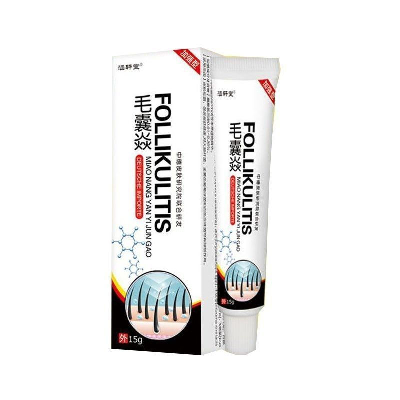 Acne, pustules, scalp ringworm, German ringworm, back acne, folliculitis12y Cream for relieving itch