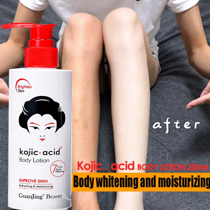 Kojic acid Whitening Lightening Body Lotion Bleaching Cream Retinol A & Vitamin E Dark Spot Treatmen