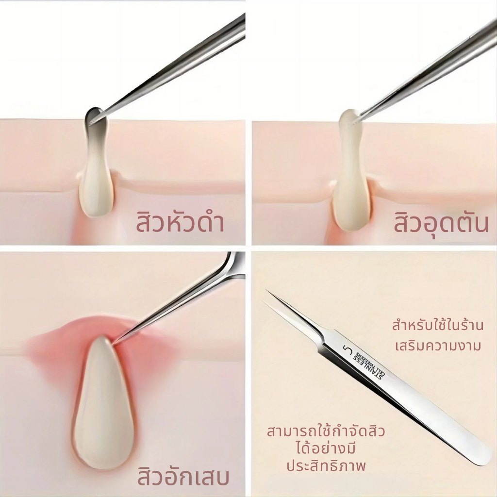เซตแหนบกำจัดสิวหัวดำ 3 ชิ้น พกง่าย ใช้งานคล่อง เครื่องมือดูแลผิวหน้าแบบครบเซตสำหรับสิวเสี้ยน สิวอุดตัน และขนคุด - รูปที่ 4