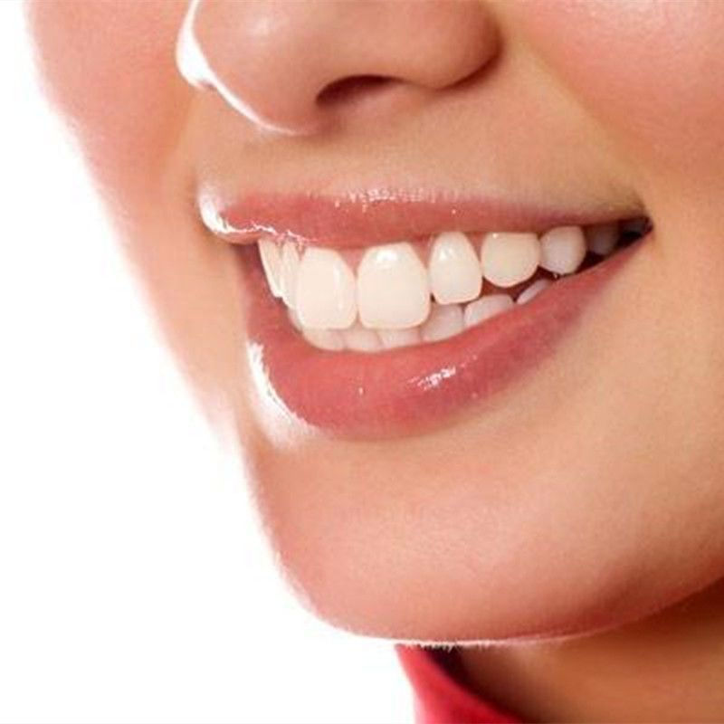 New Product#Temporary cover-up for porcelain crowns, porcelain teeth, metal porcelain teeth, chipped
