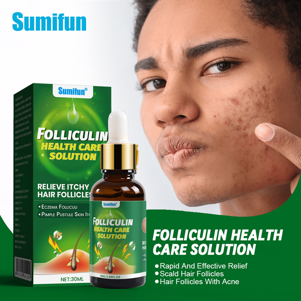Sumifun Hair Follicle Health Lotion โลชั่นบํารุงผิวข้ามพรมแดน K600179.9