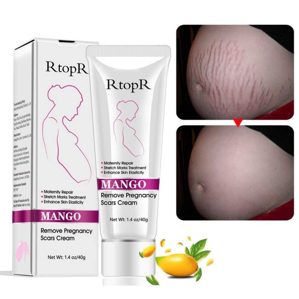Ofanyia Stretch Mark Removal Cream Repair Scar Stretch Mark Remove Stretch Mark Scar Cream