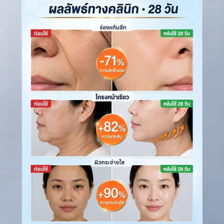 ⚡️COD⚡️ [เพิ่มความชุ่มชื้น] ครีมซ่อมแซมผิวสูตรอ่อนโยนน้ำหนักบางเบาลดรอยแดง ครีมบำรุงผิวบำรุงล้ำลึกปรับสภาพผิว ครีมดูแลผิวฟื้นฟูผิวเสียเติมน้ำให้ผิว