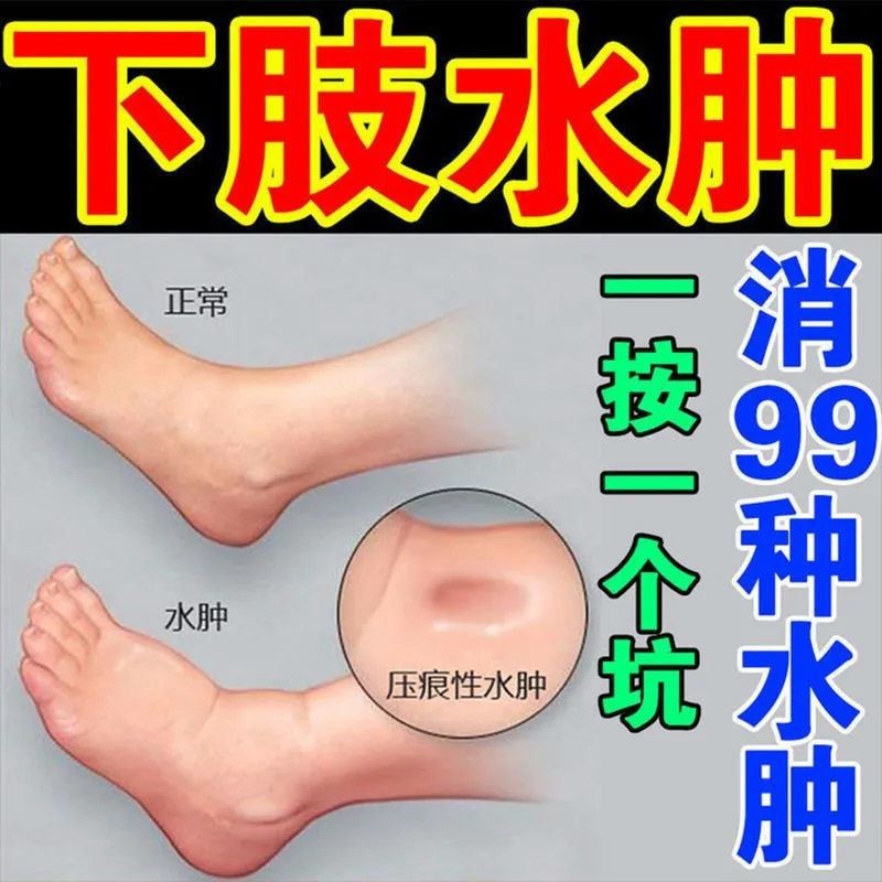 Edema-Reduction Handy เครื่องมือยา Lower Limb ผ้าอ้อมระบายน้ําผ้าอ้อม Face ผู้สูงอายุ Edema-Reductio