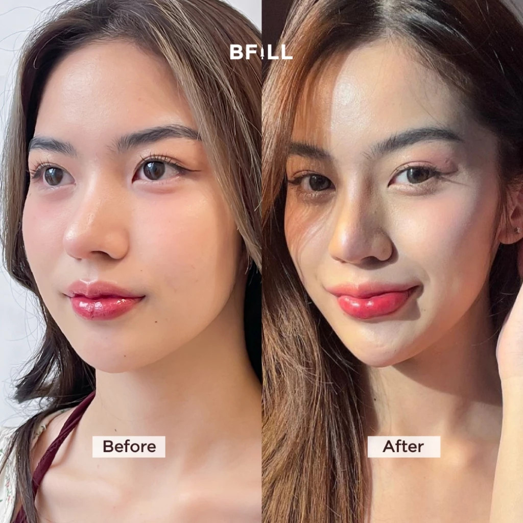 100 Unit Korea ren to xin 200 Unit Facial Hydrating Freeze-Dried Powder - รูปที่ 2