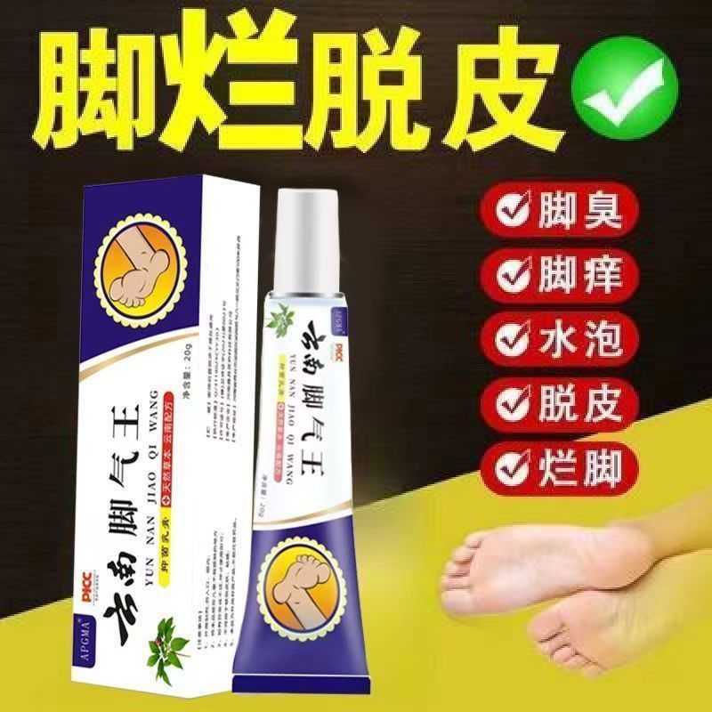 พร้อมสต็อก เชื้อรา King Athletes Foot Anti-itch Anti-acteria Peeling Blister Bad Foot Stinky Foot It