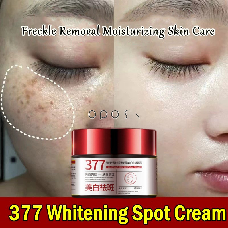 Original Official377 Skin Whitening Cream Moisturizing Brightening Fade Dark Spots Even Skin Tone An
