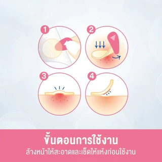 3M nexcare แผ่นซับสิว " รุ่นมาตราฐาน 18 ชิ้น แปะสิว รุ่นมาตรฐาน(กล่องชมพู)