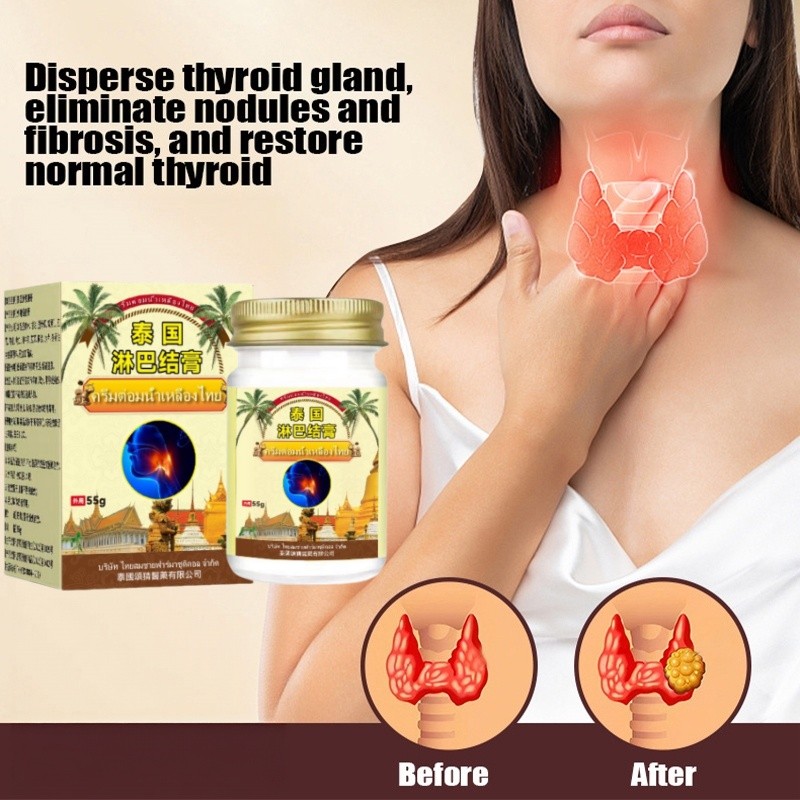 ครีมจมูกน้ําเหลืองไทยสําหรับครีมกําจัดไขมันน้ําเหลืองไม่สบาย Axillary บวม Lymph Node Dispersing ครีม