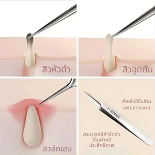 แหนบสิว 3 ชิ้นพร้อมกล่องเก็บ กำจัดสิวหัวดำ สิวเสี้ยน และสิวอุดตันได้อยู่หมัด เหมาะทั้งใช้เองและในร้านเสริมสวย