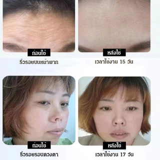 🔥สินค้าขายดี🔥ครีมกระชับผิวกำจัดโพลีเปปไทด์ ครีมลดริ้วรอย ครีมลดริ้วรอย กระชับผิว ให้ความชุ่มชื้นลดเลือนริ้วรอย เห็นผล30วัน