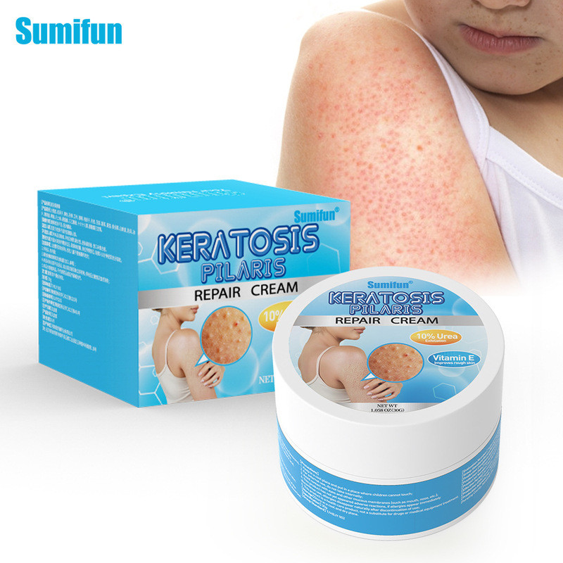 พร้อมส่ง Sumifun Vitamin E Chicken Skin Cream Urea Exfoliating Pimple K20069