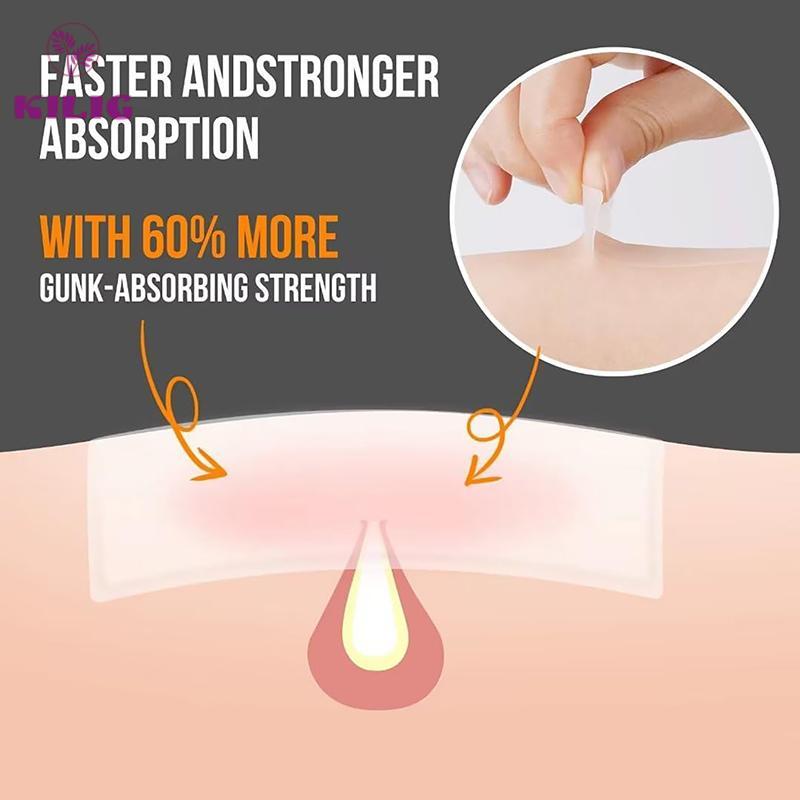 KILIG 30 ชิ้น/เซ็ตสิวแพทช์สิวที่มองไม่เห็น Skin Care สติกเกอร์คอนซีลเลอร์ Face Spot Beauty TH