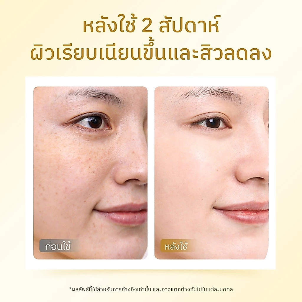 The Originote Gluta Bright B3 Serum 20ml, เซรั่มที่ประกอบด้วยวิตามิน B3 สามารถปรับผิวให้ขาวและกระจ่างใสขึ้น thumbnail 4