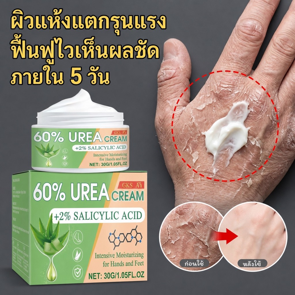 POZOAMIS ครีมทามือและเท้าเชียบัตเตอร์ บำรุงผิวแห้งให้ความชุ่มชื้น ซึมซาบเร็ว เหมาะสำหรับทั้งครอบครัว