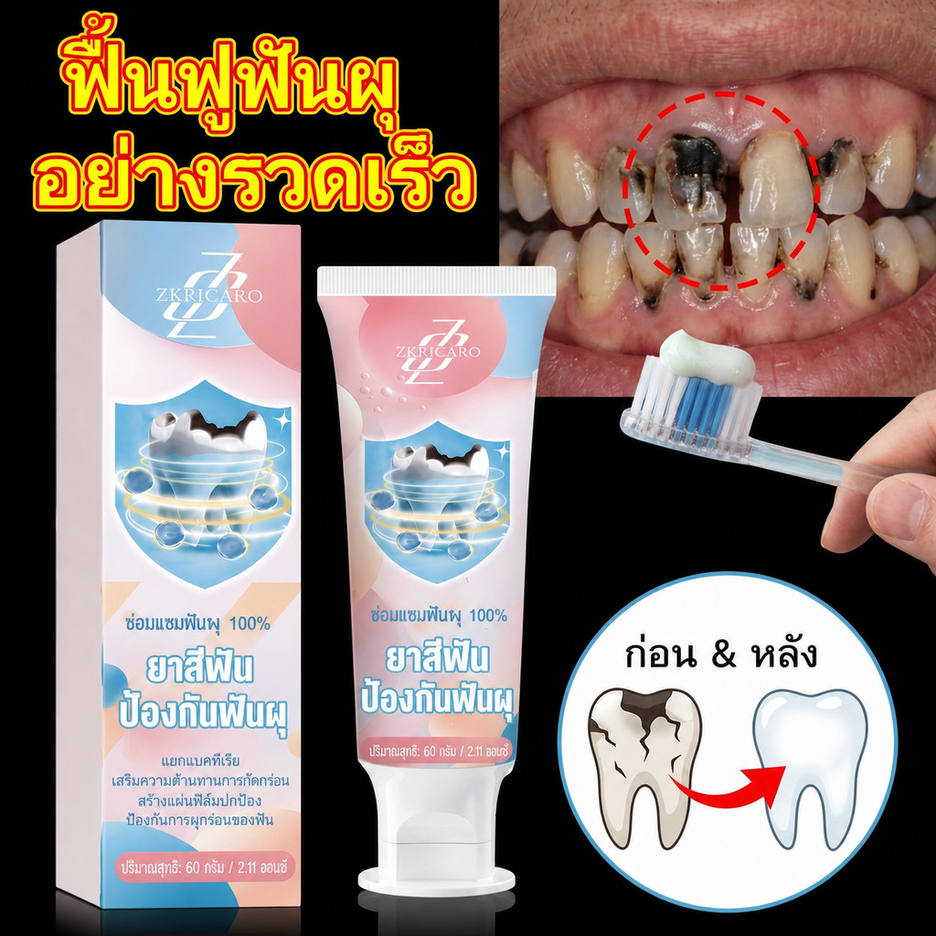 ยาสีฟันดูแลช่องปากรายวัน ลมหายใจหอมสดชื่นยาวนาน ปกป้องสุขภาพทางทันตกรรม
