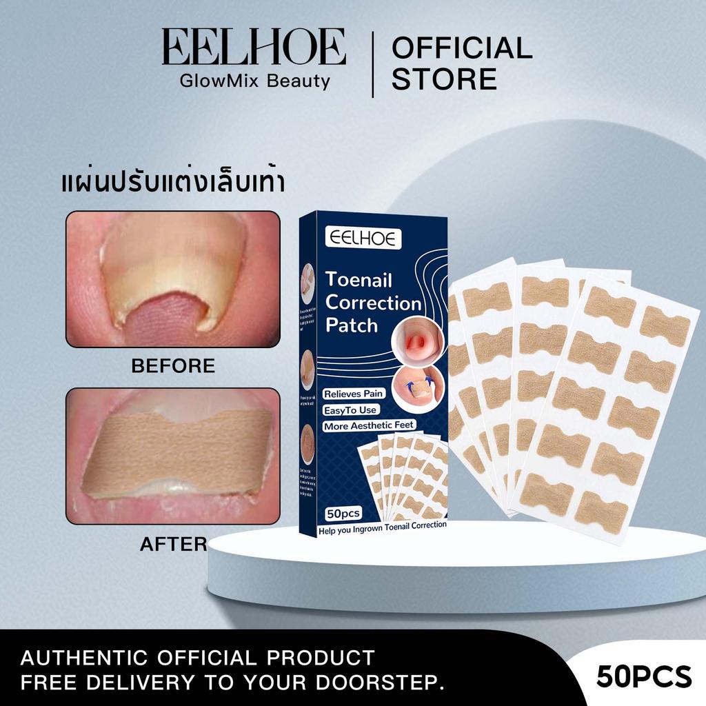EELHOE แผ่นแปะแก้เล็บขบ ซ่อมแซมเล็บเท้า เล็บขบ เล็บคุด ใช้ติดเล็บเท้า ระบายอากาศได้ดี ติดแน่น ใช้งานง่าย 50ชิ้น