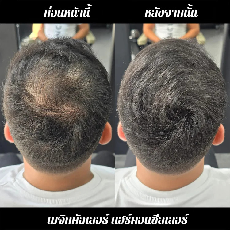 🩵มีคนจำนวนมากซื้อ🩵 【มีผลทันที คงอยู่ได้นาน 10 วัน】คอนซีลเลอร์ปิดเหม่ง กันน้ำ/กลบรอยล้านบนศีรษะ​/​​คอนซีลเลอร์สำหรับคนผมบาง​/ร์ป้องกันรอยเปื้อนติดทนนานกันน้ําและกันเหงื่อ - รูปที่ 2